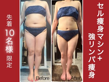 アミナス(Total Beauty Salon AMINAS)の写真/《10月18日まで！》【全身｜セル痩身マシン＋強リンパ★90分￥6900】先着10名様限定！ご予約はお早めに♪