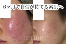 ベルリール 浜松店(BELRIR)