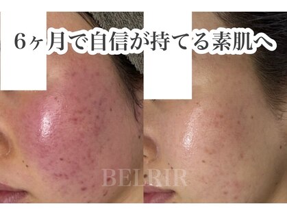 ベルリール 浜松店(BELRIR)の写真