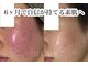 ベルリール 浜松店(BELRIR)の写真