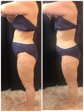 ビューティー アディクト(Beauty addict)/セルゼロ全身コース★