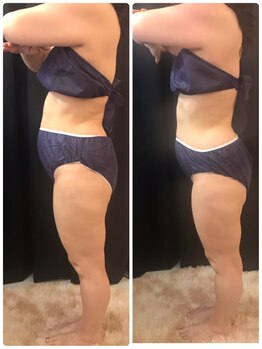 ビューティー アディクト(Beauty addict)/セルゼロ全身コース★