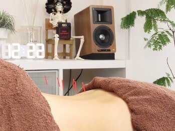 いとう鍼灸整体院 代官山恵比寿/鍼施術