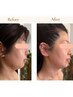 【40.50代人気No.1】くすみ、たるみにお悩みの方に驚きの変化♪ヘッドスパ付