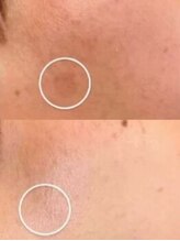 ラエッセ 目黒 白金台店(LAESSE)/毛穴・美白専門店 LAESSE 白金台