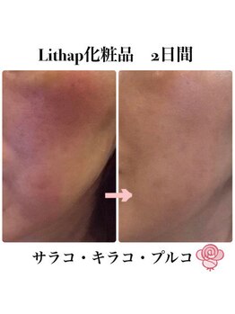 ケンビラク(Kenbiraku 健美楽)/Sarako・Kirako・Pruko &nbsp;2日間