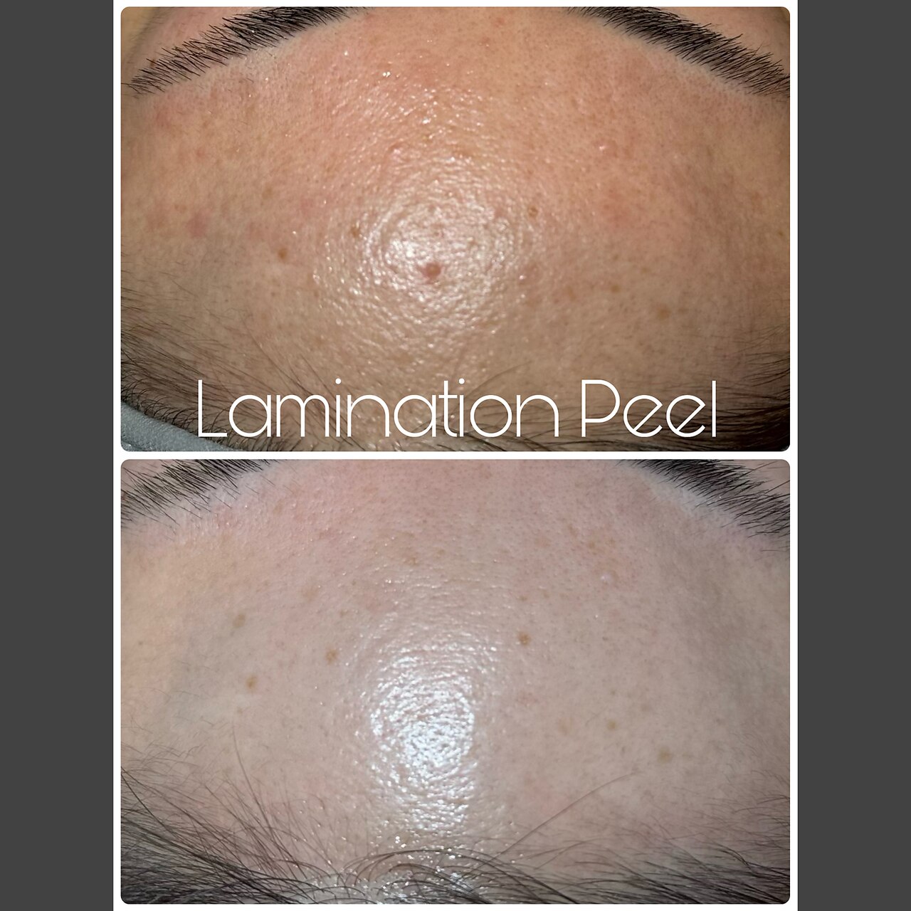 肌質改善エステサロン♡ エステティックサロン フィール(feel)｜ホットペッパービューティー