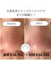 【エンビロン】ピーリング×毛穴洗浄　黒ずみ毛穴最強ケアコース80分　岐阜