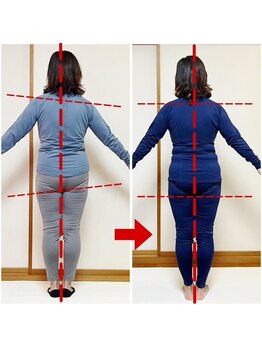 オステオデイジー(OsteoDaisy)/こんな姿勢に心当たり