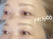 パチ(pachi)/次世代まつ毛パーマ