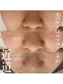 プラセル(Placer)/毛穴ケアはコツコツが近道☆