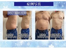 シュシュ(CHUCHU)の雰囲気（最新360°脂肪冷却）