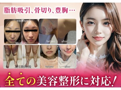 ミカド 銀座(mikado)の写真