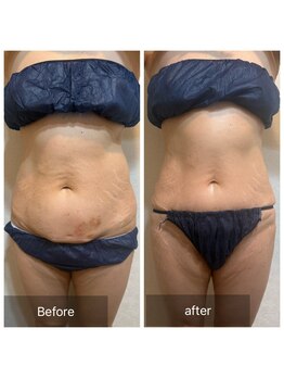 コマ(KOMA)/3ヶ月でこの変化!