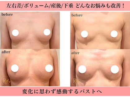 ラヴィス(ravis)の写真