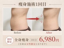 エヌ(N)