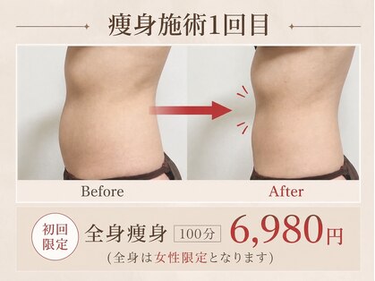 エヌ(N)の写真