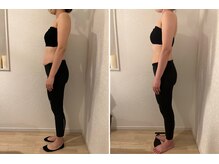 優子さんの美容矯正サロン/ブライダルは痩せるだけではNG