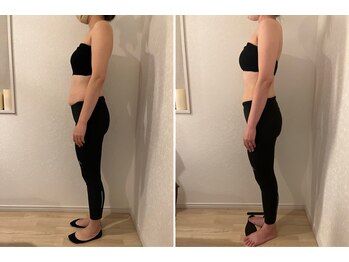 優子さんの美容矯正サロン/ブライダルは痩せるだけではNG