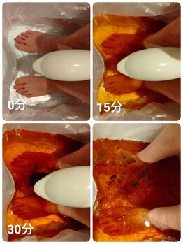 ハピエスト 田辺店/デトックスマシーン