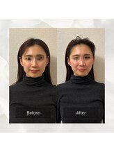 サワエギンザ(SAWAEGINZA)/before→after