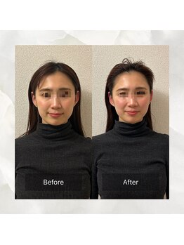 サワエギンザ(SAWAEGINZA)/before→after