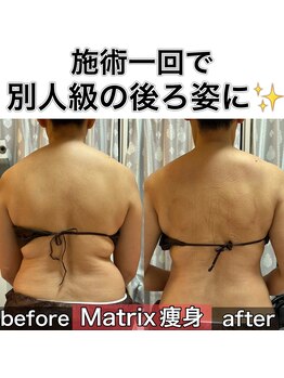 サロンデイジー(Salon Daisy)/Matrix痩身☆施術一回