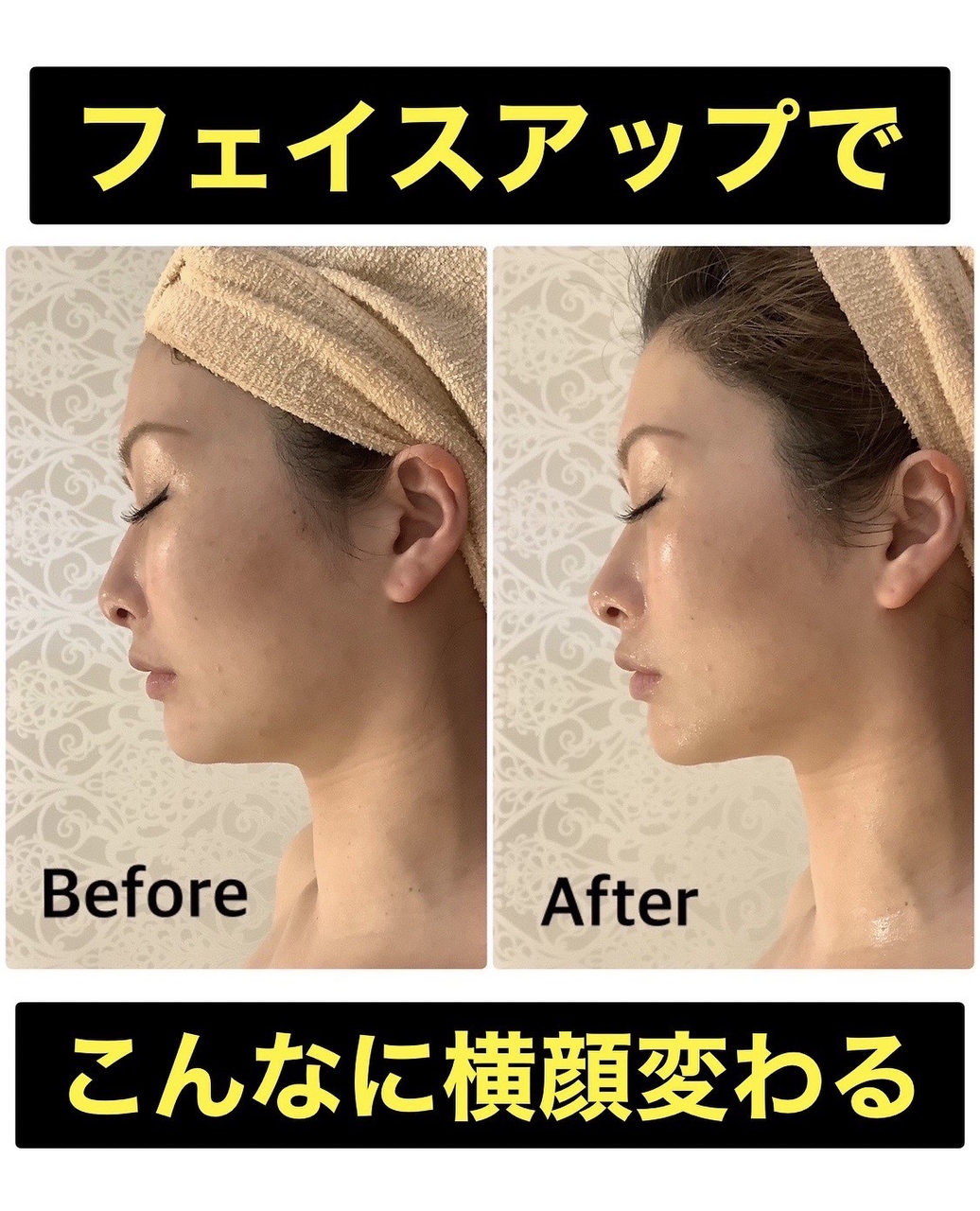 スペチアーレ 夙川/驚きの引上がりで顔がシャープに