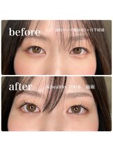 イロ(IRO)/&healthy100本