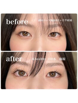 イロ(IRO)/&healthy100本