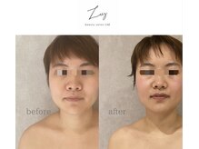 ラズ(Luz)の雰囲気（【小顔】首、肩まわりからお顔がキレイに見えるように整えます）
