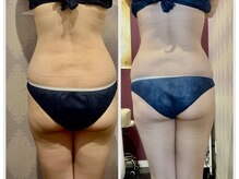 プリマヴェーラ(PRIMAVERA)/骨盤