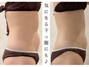 リアレント 高槻店(Lialent)/2ヶ月で無理なく-5kg達成♪30代