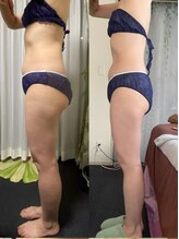 ワミ 八潮(WAMI)/痩身10回