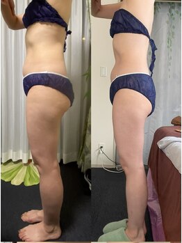 ワミ 八潮(WAMI)/痩身10回