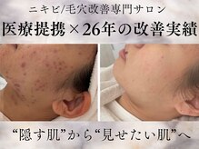 サロンドエクラ 南堀江(salon de eclat)