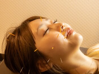 たきもと鍼灸整骨院の写真/【初めての方も◎】体の凝り/睡眠/自律神経を整え体の内側から健康を促進☆美容鍼+EMS即効小顔4,700円