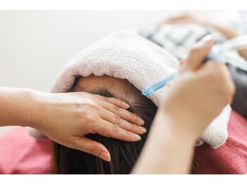 きれいサロン スマイリー(Smiley)の写真/頭皮のフケ対策には頭皮洗浄です!匂いや皮脂を整えたい方に、お得な体験をご用意しました♪