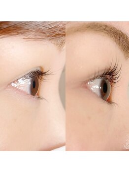 リファイン(Refine)/