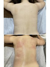 セラス(CERAS)/フォースカッター　背中30分