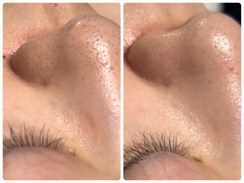 ベルドア(Bell Door)/夏の毛穴ケア