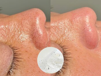 ルーナジェーナ(Luna llena)/池袋　エステ　ルーナジェーナ