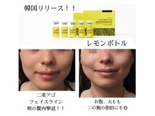 リメイク(Re make)の雰囲気（最新☆小顔効果抜群！！オーガニック脂肪分解剤ダウンタイムなし）