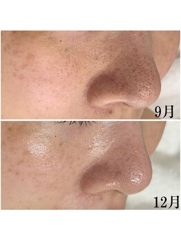 プラセル(Placer)/ホームケアを一新して