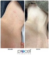 ヒルナム(Heal Nam)/プロセルセラピーズ~フェイス~