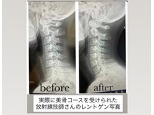 アン シエロン(an cielon)の雰囲気（ストレートネック改善。首から整える小顔・頭痛・首肩こり・不眠）