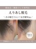 ≪うなじSET≫襟足MIX脱毛｜WAX＆美容脱毛付◆＋LEDトリートメント￥8000