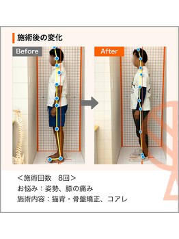 ただき接骨院 整体院 新前橋院/お悩み：姿勢、膝の痛み