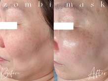 キスミー(Ksmiii)/小じわ改善！ゾンビマスク