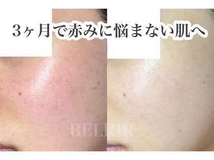 ベルリール 浜松店(BELRIR)の写真